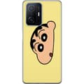 Pikkukuva 1 / 3: Xiaomi 11T Pro Läpinäkyvä kuori Peeking Shinchan