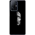 Miniatyrbillede 1 af 3: Xiaomi 11T Pro Gennemsigtig cover Keffiyeh-mønster - klassisk sort-hvid palæstinensisk tørklæde med kulturel betydning