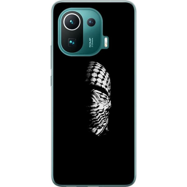 Xiaomi Mi 11 Pro Läpinäkyvä kuori Keffiyeh-kuviointi - klassinen palestiinalainen mustavalkoinen shaali, jolla on kulttuurinen merkitys
