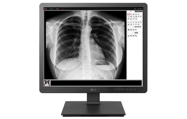 LG 19HK312C-B, 48,3 cm (19"), 1280 x 1024 piksler, SXGA, 14 ms, Svart