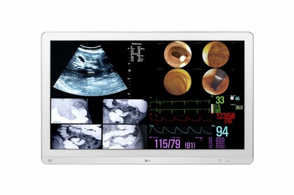 LG 32HL714S-W, 80 cm (31.5"), 3840 x 2160 pikseliä, 4K Ultra HD, 14 ms, Valkoinen