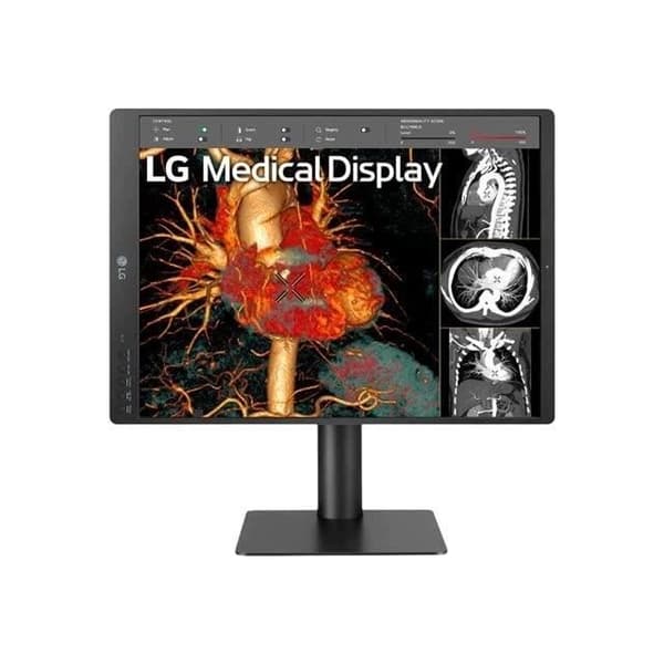 LG 21HQ513D-B-21'' GRÅSKALA 3MP 54,1 CM (21,3'') 1536 X 2048 PIXEL H Svart
