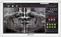 Pikkukuva 2 / 3: Monitor 21.5 inches DR-2202 IPS NeoV GLASS 9H IP65* DICOM 500CD/M2 1000:1 5MS DP HDMI VGA USB SPEAKERS WHITE