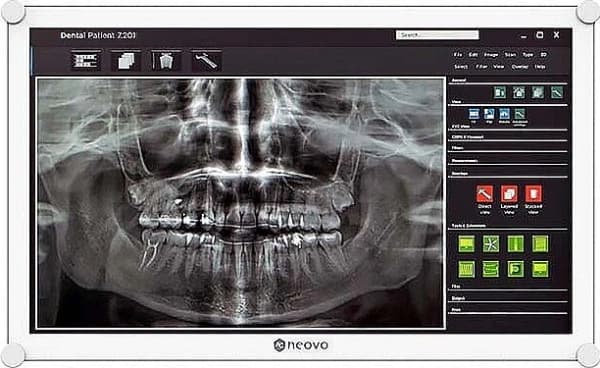 Monitor 21.5 inches DR-2202 IPS NeoV GLASS 9H IP65* DICOM 500CD/M2 1000:1 5MS DP HDMI VGA USB SPEAKERS WHITE