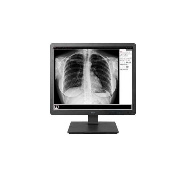 LG SKÄRM 19 SVART IPS 1.3MP 330 Svart