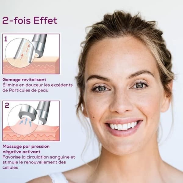 BEURER FC 100 - Microdermabrasion system - Professionell ansiktshudexfoliering hemma
