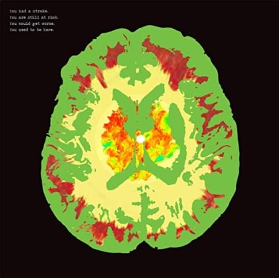 Minus 5 The - Stroke Manor (CD)