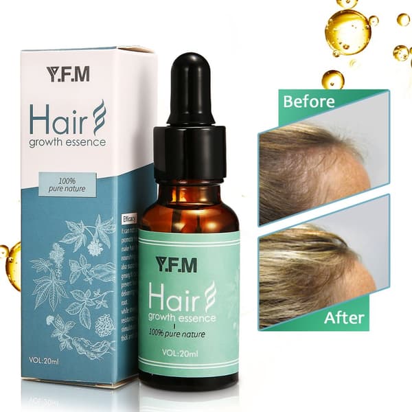 YFM 20 ml Nopeaa hiustenkasvua tiheää Regrowth Serum Oil Anti Loss Hoitoesanssit