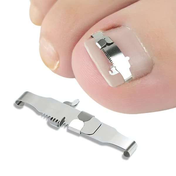 INF Groove Nail Correction Kit med Dead Skin Pusher Nail Corrector PE-tejp