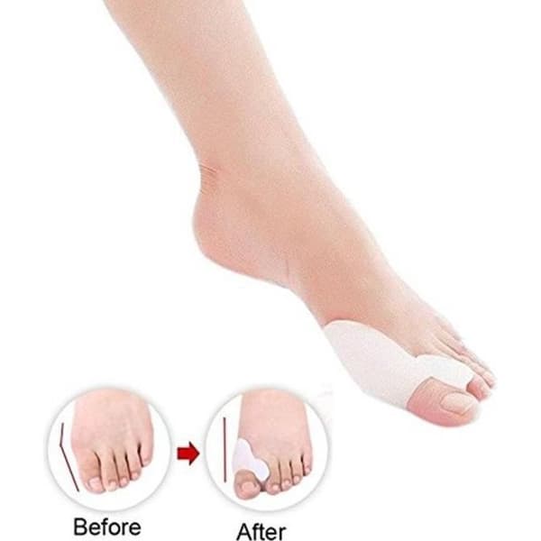 Dr.Pedi Gel Toe Bunion Corrector Hallux Valgus Separators Pro Toe Stretchers Bunion Straightener Alignment (1 par): Skönhet