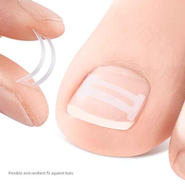 INF Heltäckande nageltippar med spetsmönster, 10 tippar/låda