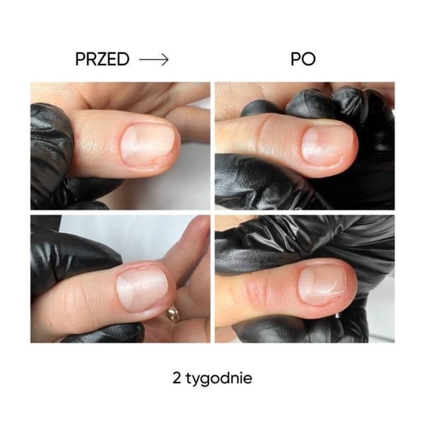 NAILSOFTHEDAY ONISTOP - uudistava öljy kynsille, joilla on kynsilevä, 8 ml