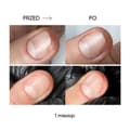 Pikkukuva 5 / 8: NAILSOFTHEDAY ONISTOP - uudistava öljy kynsille, joilla on kynsilevä, 8 ml