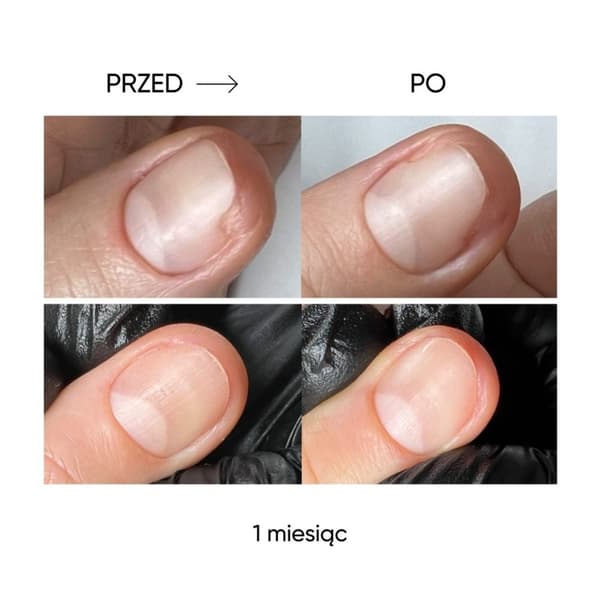 NAILSOFTHEDAY ONISTOP - uudistava öljy kynsille, joilla on kynsilevä, 8 ml
