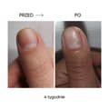 Pikkukuva 7 / 8: NAILSOFTHEDAY ONISTOP - uudistava öljy kynsille, joilla on kynsilevä, 8 ml