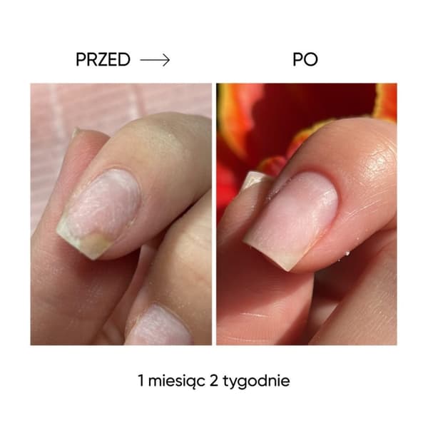 NAILSOFTHEDAY ONISTOP - uudistava öljy kynsille, joilla on kynsilevä, 15 ml
