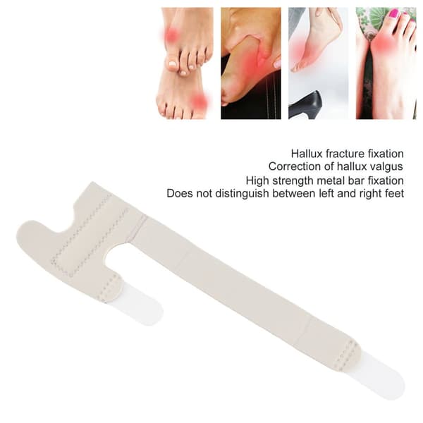Tåstøtte Bærbar Åndbar Justerbar Brud Genopretning Fiksering Hallux Valgus Corrector Grå