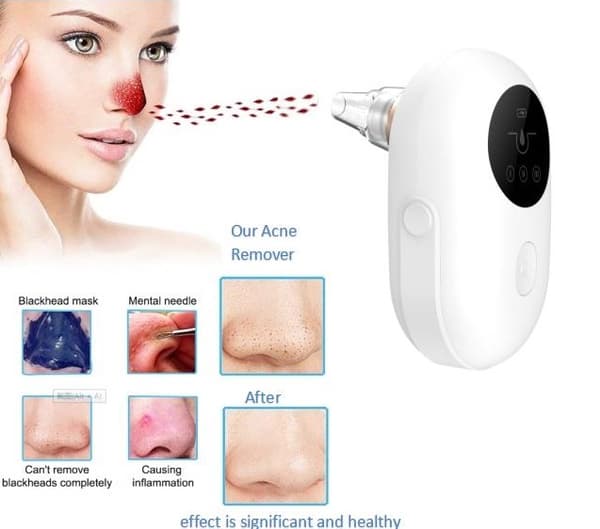 Cenocco Beauty Blackhead Cleaner (CC-9098)