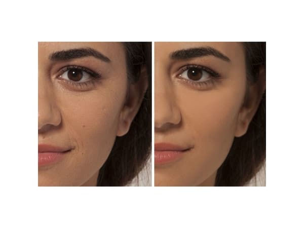 L'Oréal Paris (julkinen) Accord Parfait, Beige, 4N, Beige, Yhdistelmäiho, Voide, Pullo, Pullollinen