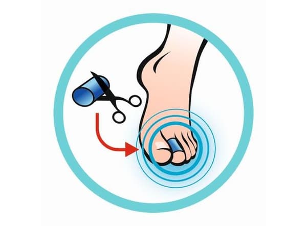 SIDAS GEL TOE WRAPS (x4), skavsårsskydd tår, silikonsleeve för tår