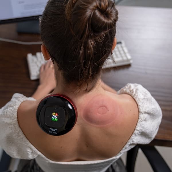 Cupping elektrisk - 12 nivåer