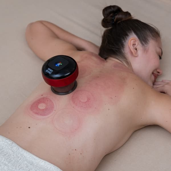 Elektrisk Cupping 12 niveauer