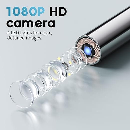 Trådlös Otoskop/Öronrensare med 1080P Kamera – Smart Öronrengörare för Säker Öronrengöring