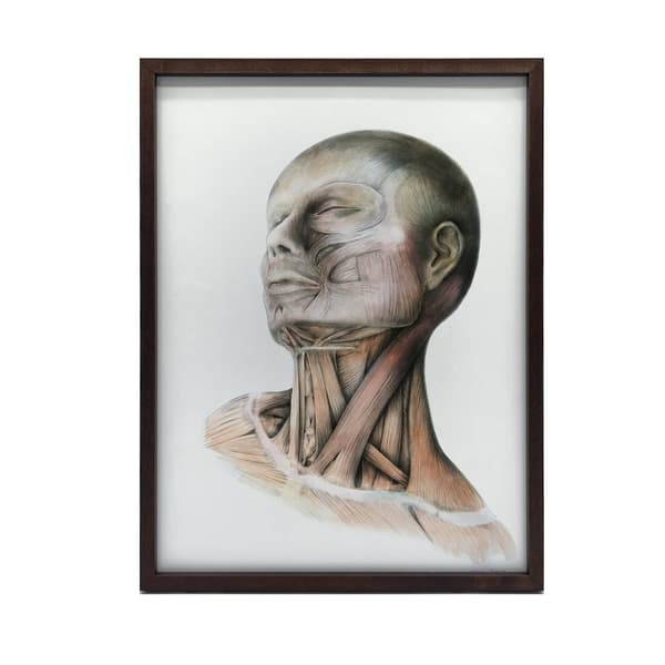 Nakkemuskler - Anatomisk plakat Nakkemuskler - Anatomisk plakat, 50x70 cm, mørkebrun træramme, 230 gsm mat papir