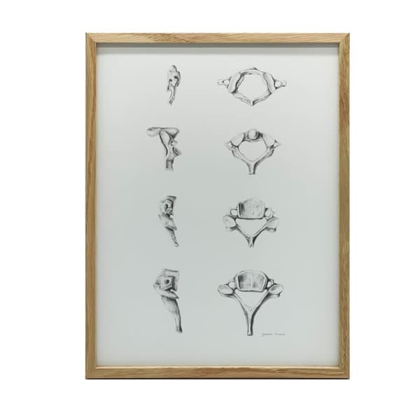Anatomy of the Cervical Vertebrae - Anatomisk plakat Anatomy of the Cervical Vertebrae - Anatomisk plakat, 70x100 cm, sort aluminiumsramme, 230 gsm ma