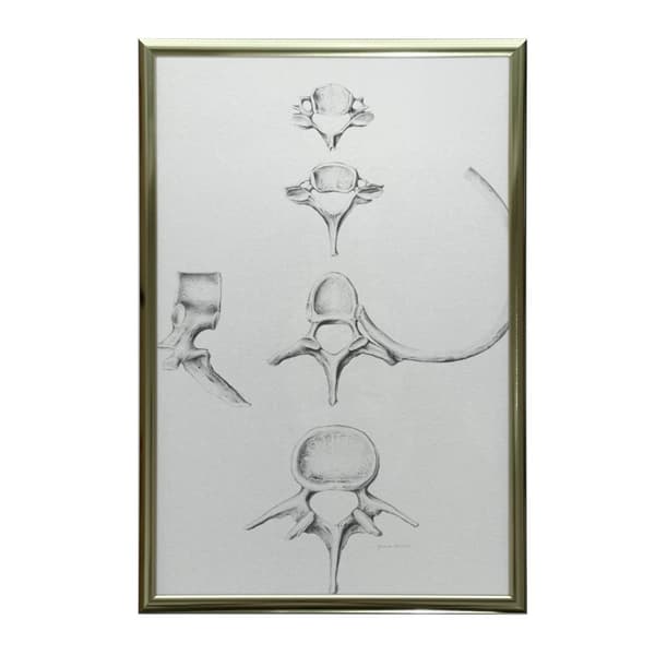 Ryg i detaljer: Anatomi af C6, C7, Th5 og L4 - Anatomisk plakat Rygsøjle i detaljer: Anatomi af C6, C7, Th5 og L4 - Anatomisk plakat, 50x70 cm, guld a