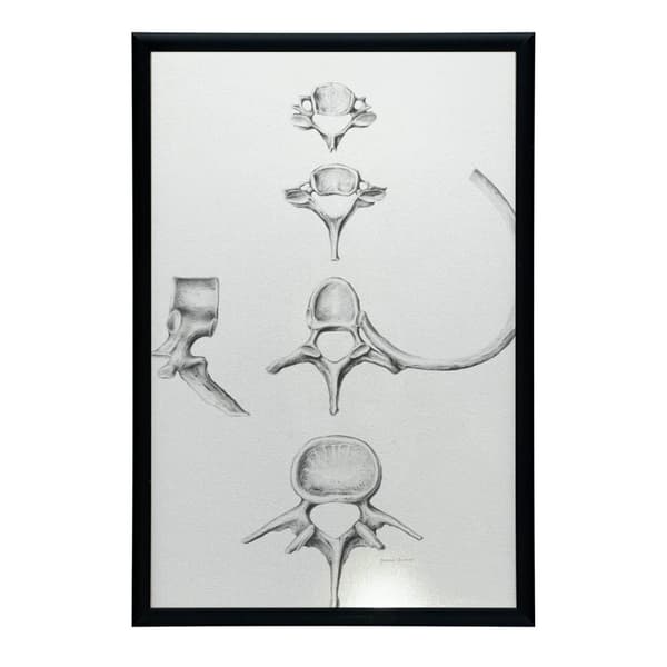 Rygsøjle i detaljer: Anatomi af C6, C7, Th5 og L4 - Anatomisk plakat Rygrad i detaljer: Anatomi af C6, C7, Th5 og L4 - Anatomisk plakat, 60x90 cm, gul