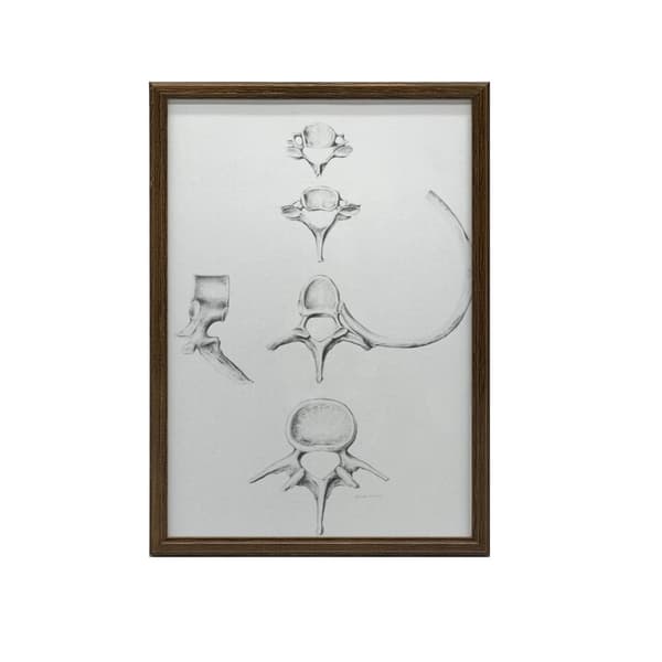 Rygsøjle i detaljer: Anatomi af C6, C7, Th5 og L4 - Anatomisk plakat Rygrad i detaljer: Anatomi af C6, C7, Th5 og L4 - Anatomisk plakat, 60x90 cm, gul