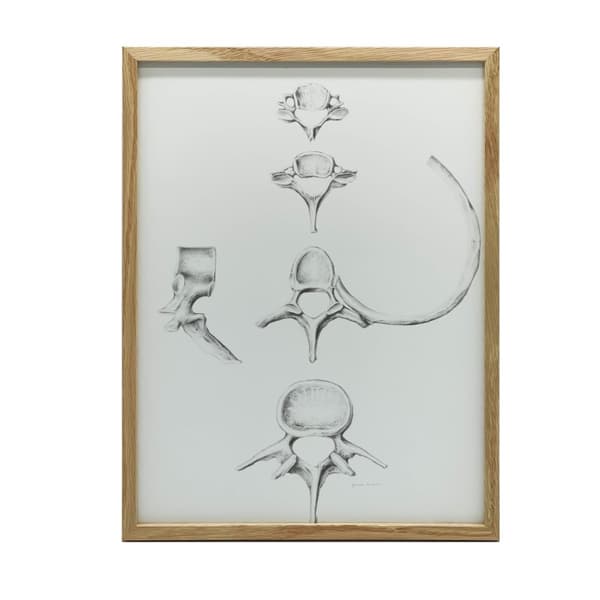 Rygsøjle i detaljer: Anatomi af C6, C7, Th5 og L4 - Anatomisk plakat Rygrad i detaljer: Anatomi af C6, C7, Th5 og L4 - Anatomisk plakat, 60x90 cm, gul