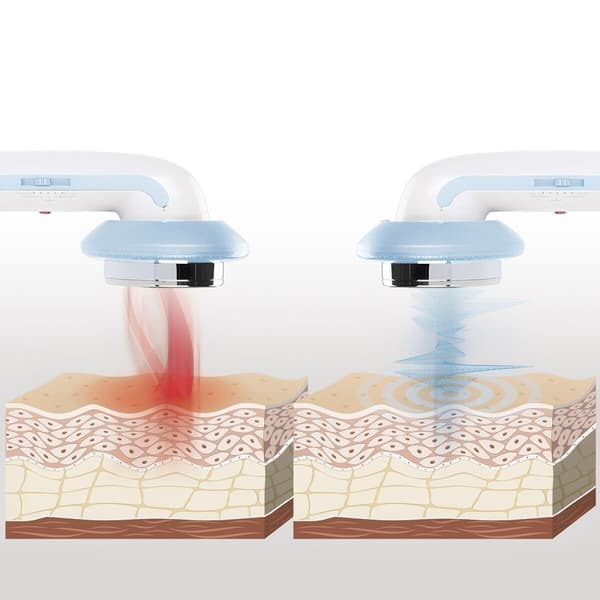 3-i-1 Massageapparat Anti-celluliter med Ultraljudskavitation med Infravärme och Elektrostimulering CellyMax InnovaGoods