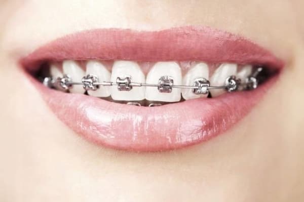 Atos SALVIA ORTHO DENTAL NIGHT 75M Atos SALVIA ORTHO DENTAL NIGHT 75M