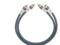 Pikkukuva 1 / 3: OEHLBACH NF 14 MASTER, RCA, Hanstik, RCA, Hanstik, 2 m, Antrasiitti, OEHLBACH NF 14 MASTER, RCA, Hanstik, RCA, Hanstik, 2 m, Antrasiitti