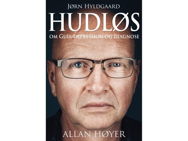 Hudløs | Allan Høyer | Kieli: Tanska