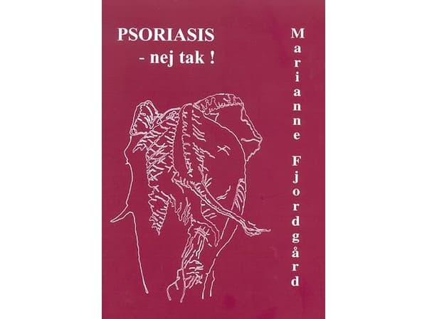 Psoriasis - nej tak! | Marianne Fjordgård | Språk: Danska