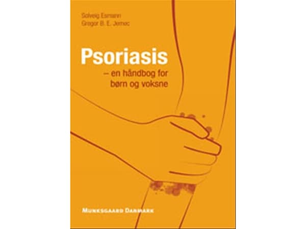 Psoriaasi | Solveig Esmann;Gregor B.E. Jemec | Kieli: Tanska