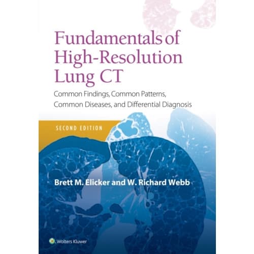Fundamentals of High-Resolution Lung CT (häftad, eng)