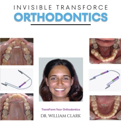 Invisible TransForce Orthodontics (inbunden, eng)