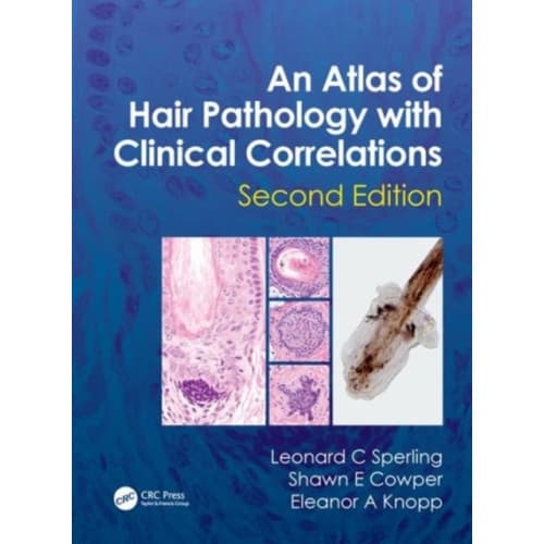 An Atlas of Hair Pathology with Clinical Correlations (inbunden, eng)