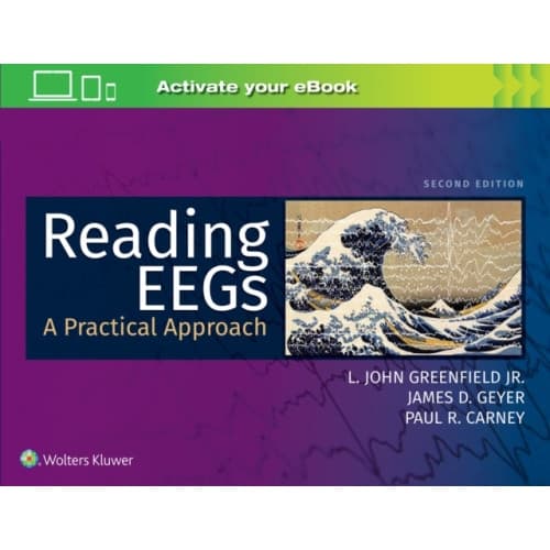 Reading EEGs: A Practical Approach (häftad, eng)
