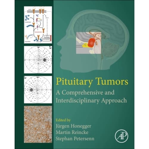 Pituitary Tumors (inbunden, eng)