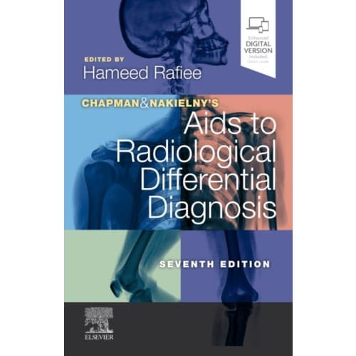 Chapman & Nakielny's Aids to Radiological Differential Diagnosis (häftad, eng)