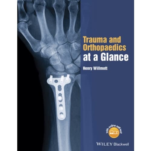 Trauma and Orthopaedics at a Glance (häftad, eng)