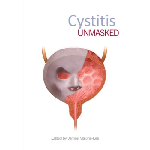 Cystitis Unmasked (häftad, eng)