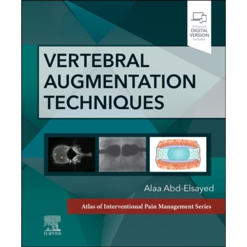 Vertebral Augmentation Techniques (inbunden, eng)