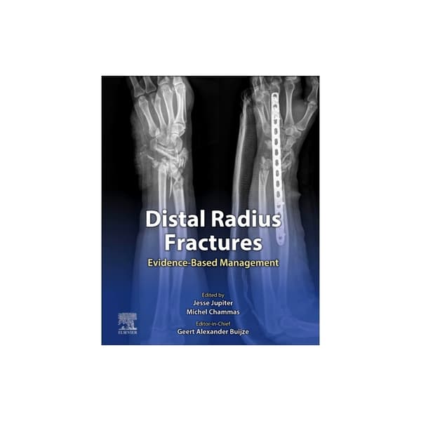 Distal Radius Fractures (inbunden, eng)