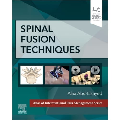Spinal Fusion Techniques (inbunden, eng)
